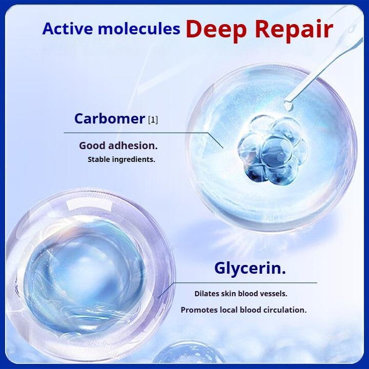 Ankle Sprain Ointment, Ankle Sprain To Reduce Swelling and Pain, Ligament Soft Tissue Injury Fluid Accumulation, Bruise Injury Ointment