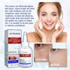 Niacinamide Brightening Blemish Fade Essence Whitening Skin Dark Spot Removal Hydrating Moisturizing Essence