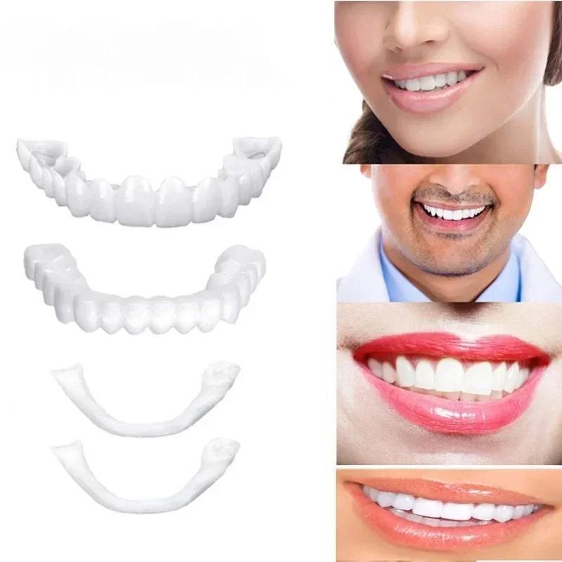 Upper and Lower Teeth Set Veneer Simulation Dental Cover Filling Material Dentals Cavity Repair Artifact Tooth Health As Comfort
