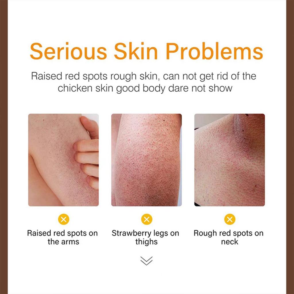 Black Removing and Whitening Essence Cream, Brightening Skin, Improving Dull Skin, Moisturizing and Nourishing Skin Care Cream