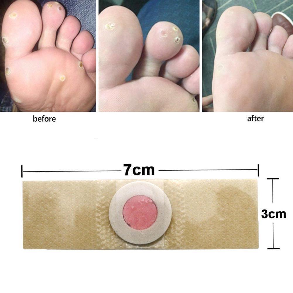 60pcs Toe And Foot Protectors Pads Corns Callus Feet Sore Shoes Sticker Self Adhesive Cushions Soft Heel Pad Foam Foot Paste