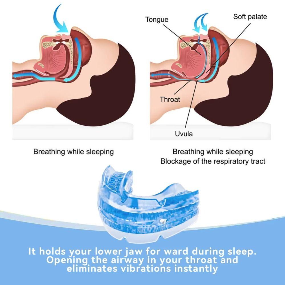 Comfortable Anti Snoring Mouth Guard With Storage Box Snoring Mouth Guard  Night Use