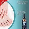 5ML/15ML/30ML/50ML/Crazylife Hand And Foot Nail Onycho Repair Nail Onychomycetant For Thickening Nail Suppressant