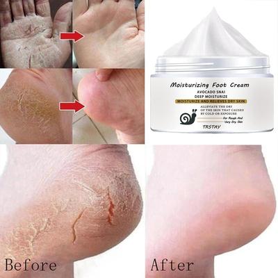 Repair Foot Cream for Chapped, Broken Hands/heels, Natural Essence Cream, Gentle and Non-irritating