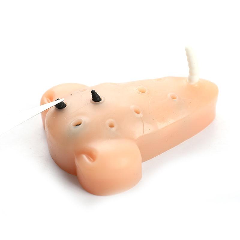 Hračky s černými tečkami, pupínky, vymačkávání akné, úlevu od stresu, hračky, odstraňovače, zastavovací hračky