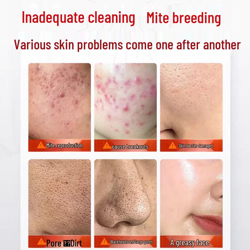 JingPeiTang Sulfur Soap for Acne, Mites & Oil Control