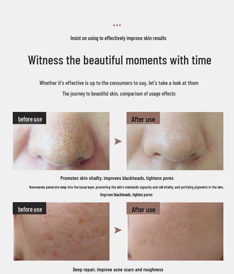 Photon Rejuvenation LED Facial Mask - Home Whitening & Beauty Device