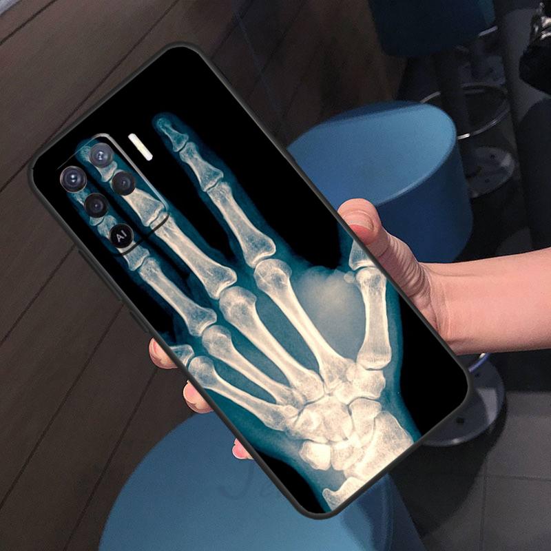 Skeleton Art Case For Oppo A40 A60 A80 A18 A38 A58 A78 A98 A96 A76 A16 A94 A74 A54 A15 A17 A57 A77 A5 Pro