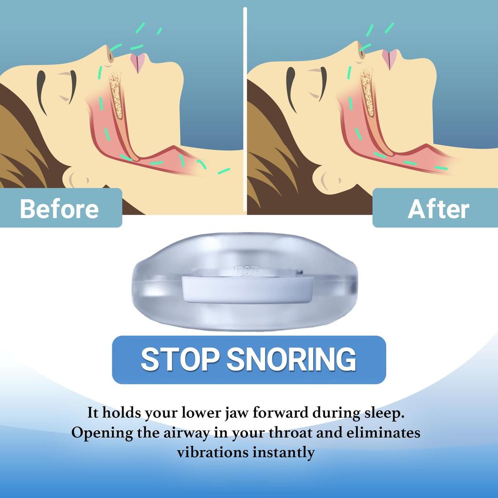 Anti Snore Device Anti Snoring Mouthpiece Adjustable Anti Grinding Teeth Guard Sleep Aid