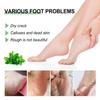 Ouhoe Moisturizing Foot Cream Rich Healing Formula For Dry Cracked Heels And Skin