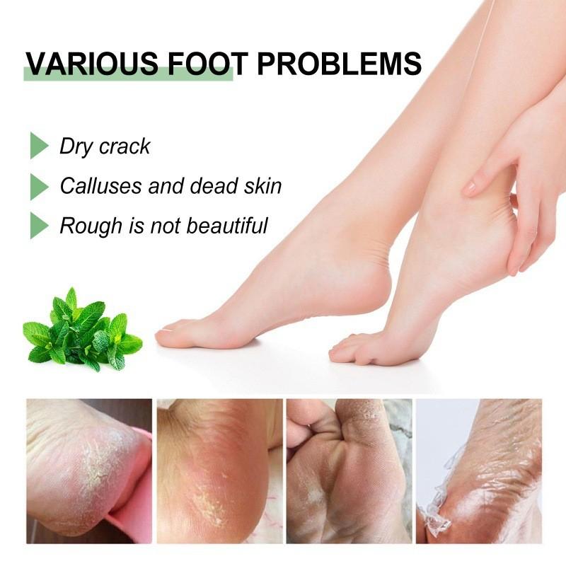 Ouhoe Moisturizing Foot Cream Rich Healing Formula For Dry Cracked Heels And Skin