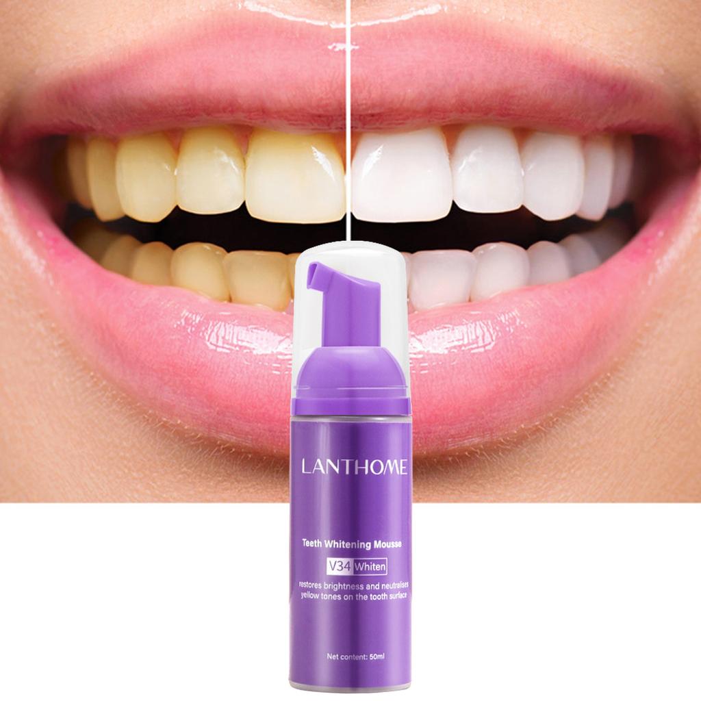 V34 Teeth Whitening Mousse – Stain Remover & Breath Freshener