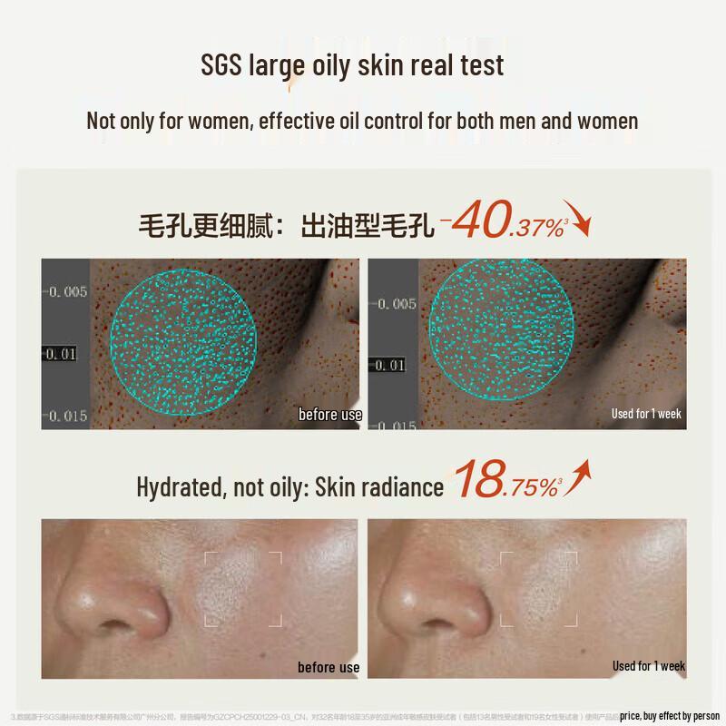 HBN Clear Oil-Control Skin Refining Essence Water