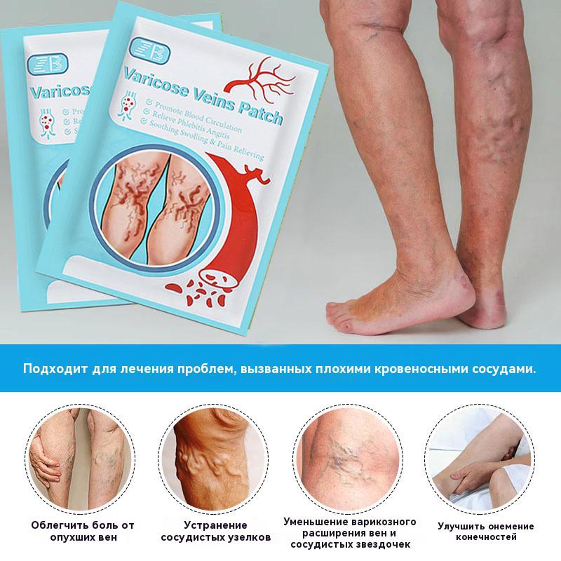 12pcs/Bag Varicose Veins Stickers Varicose Vein Healing Patch Plaster Promote Blood Circulation