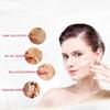 Whitening Freckle Cream Removes Melasma Yellow Spots Pigmentation Brightening Korean To Z2T2