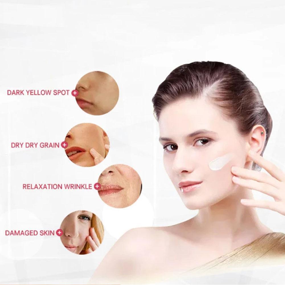 Whitening Freckle Cream Removes Melasma Yellow Spots Pigmentation Brightening Korean To Z2T2