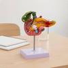 Pathologiemodell Verdauungssystem Anzeige Bauchspeicheldrüse Zwölffingerdarm Gallenblase Anatomisch Genau