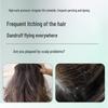 SLEK Oxygen-Active Dynamic Smooth Anti-Dandruff Shampoo
