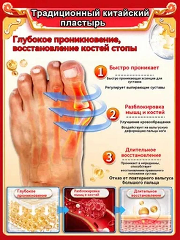 Valgomed gel with valgus deformation