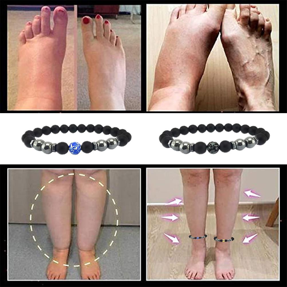 5Pcs Anti Swelling Black Obsidian Anklet Magnetic Therapy Bracelet Adjustable Weight Loss Magnet Anklet for Men Women