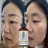 Whitening Freckle Cream Effective Remove Melasma Dark Spots Cream Fade  Moisturize Brighten Smooth Beauty Face Skin Care