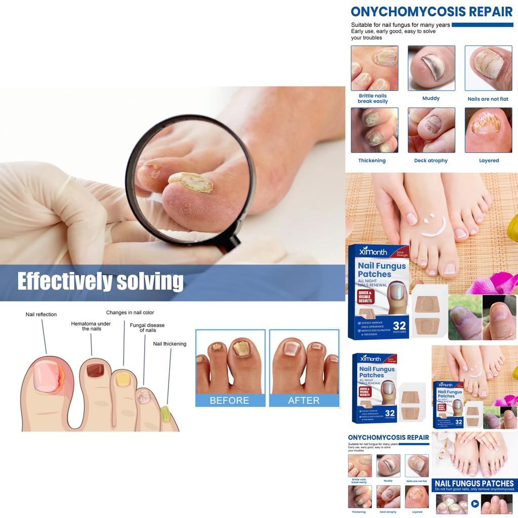 Ximonth Nail Care Patches Repairing Thickening Strengthening For Damaged Nails