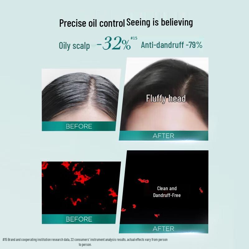 L'Oréal Salicylic Acid Oil Control Anti-Dandruff Shampoo