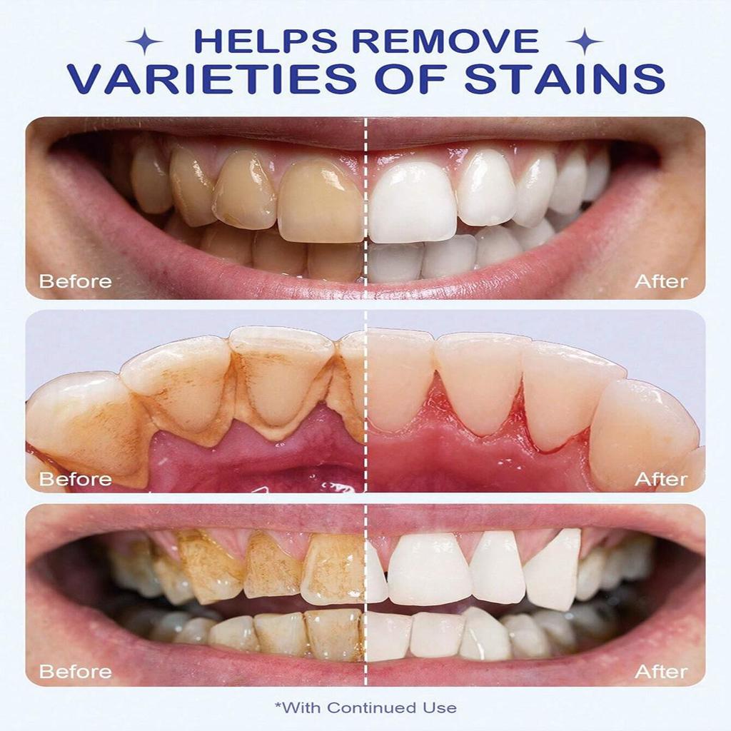 Oral Care Powder: Daily Deep Cleaning To Keep the Mouth Fresh and Maintain Oral Hygiene