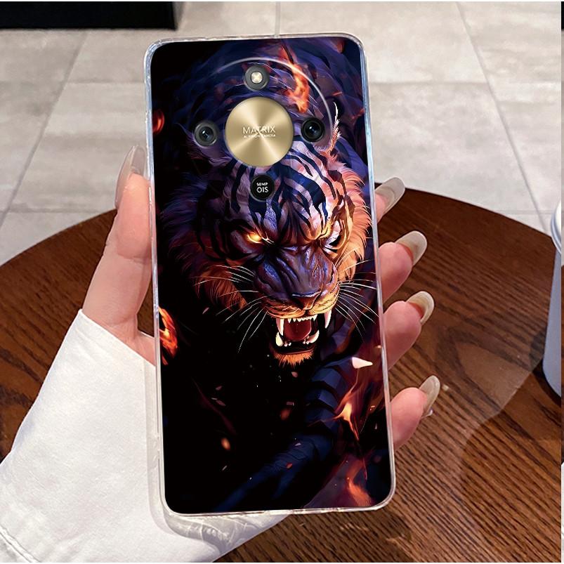 For Honor X9d 2025 Case Clear Luxury Cute Love Rabbit Funny TPU Soft Silicone Phone Case For Honor X9d 5G Transparent Back Cover