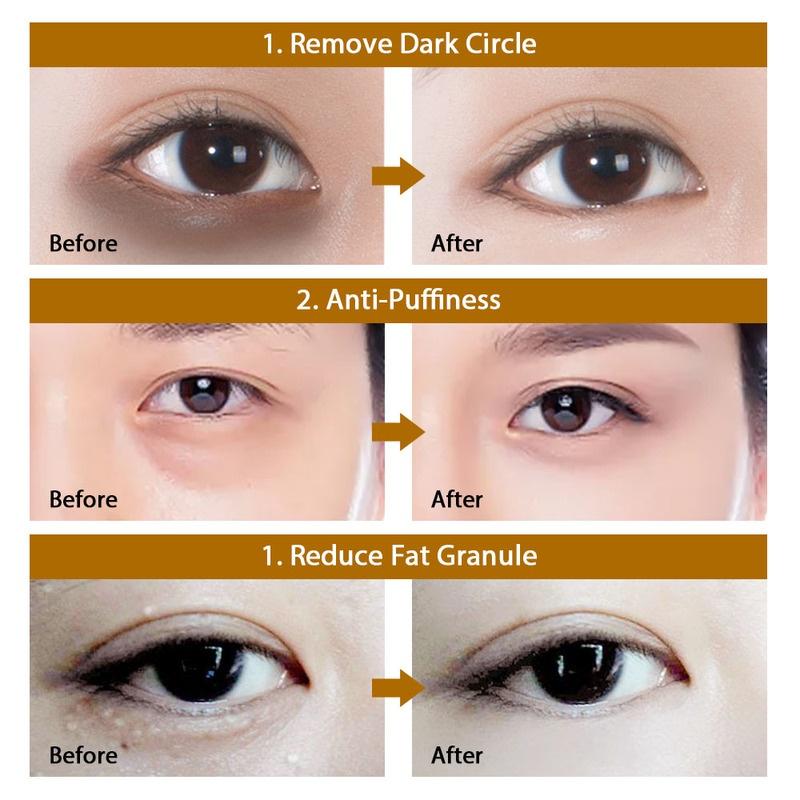 60 Tablets / Box ~ Black Pearl Collagen Mask Natural Moisturizing Gel Dark Circles Remove Moisturizing Cream To Improve Eye Bags Dark Circles Eye Mask