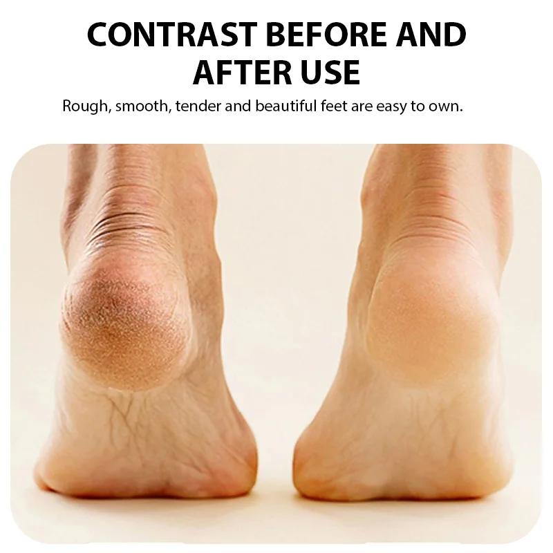 Rechargeable Electric Foot Grinder Dead Skin Remover Calluses Feet Scrubber Electric Foot File Dry Dead Cracked Foot Care Repair