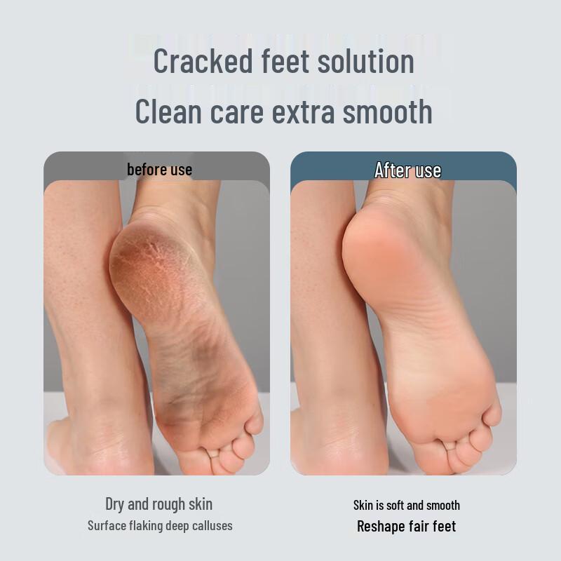 MKS Rechargeable Electric Foot File