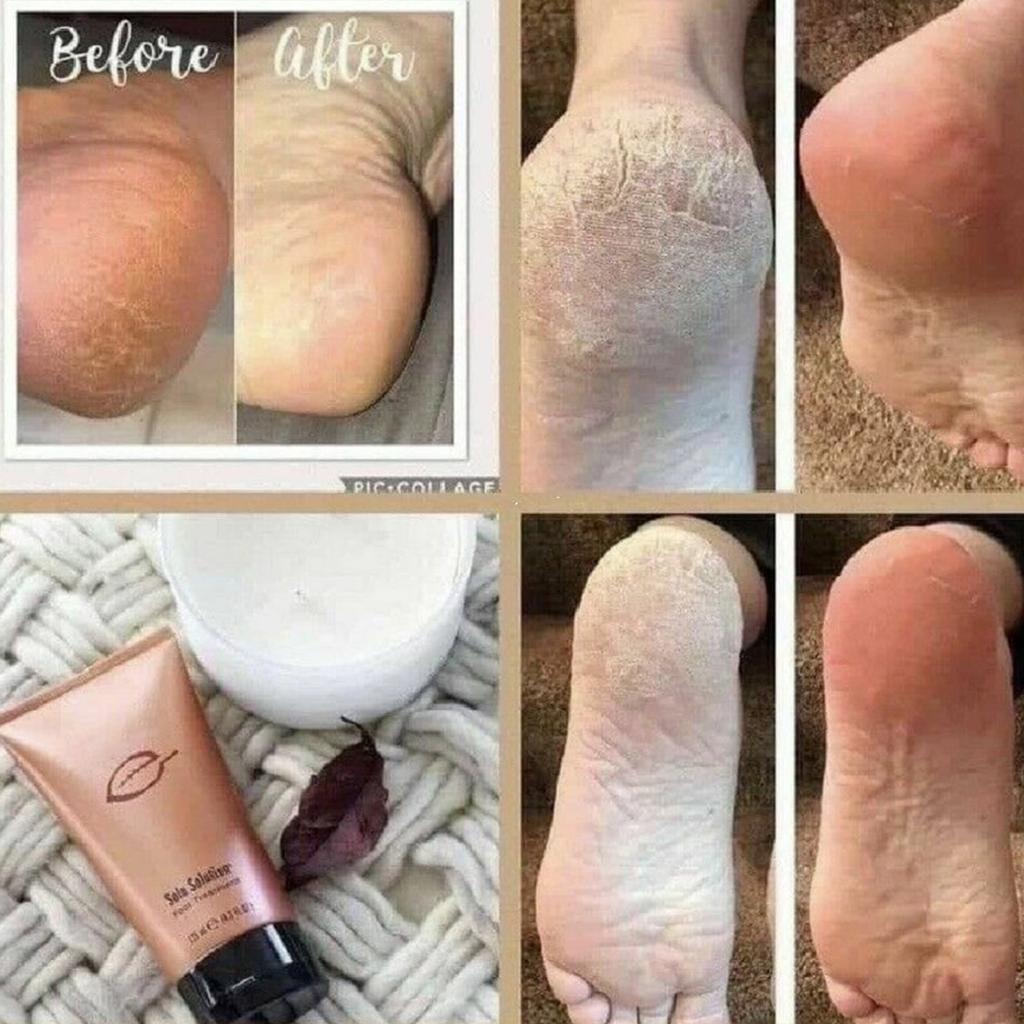 125ml Foot Care Solution