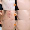 Numbuzin No. 5 Goodbye Blemish Serum 50mL (3 Options)