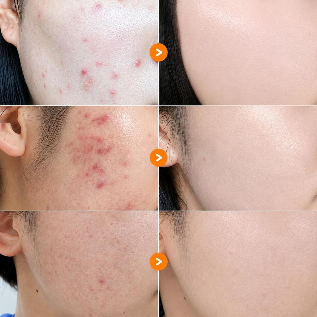 Numbuzin No. 5 Goodbye Blemish Serum 50mL (3 Options)