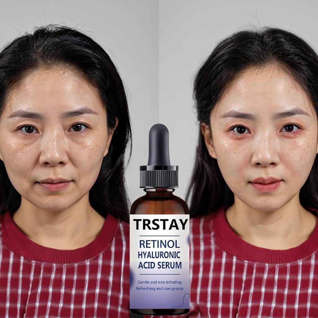 Krém na bělení pih Efektivní odstranění melasmy Krém na tmavé skvrny Vyblednutí Hydratační Rozjasnění Hladká krása Péče o pleť