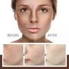 Spots Peel Off Facial Mask Freckle Pigmentation Removal Cream Chloasma Care Dark Spot Correction Glow Whiten Peeling Mask Strong