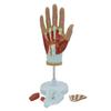 PNT-0351 Hand Anatomy Model: Medical Teaching Tool with Hand Muscle Anatomy, 4 Parts.