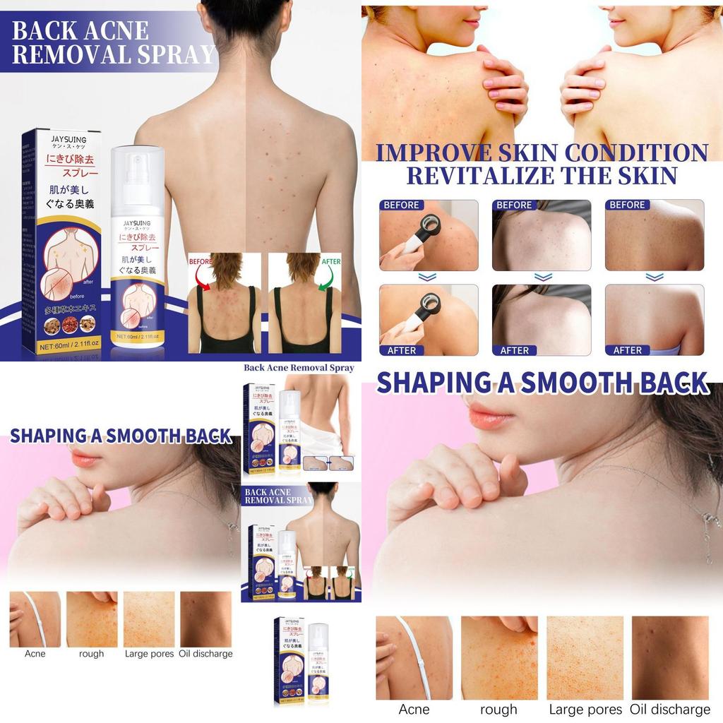Jaysuing Back Care Spray For Fading Acne Marks And Smoothing Skin Texture