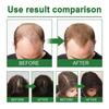 Rosemary Hair Spray for hair Growth, hair damage control | Rosemary Fast Growth Hair Spray, Pack 2