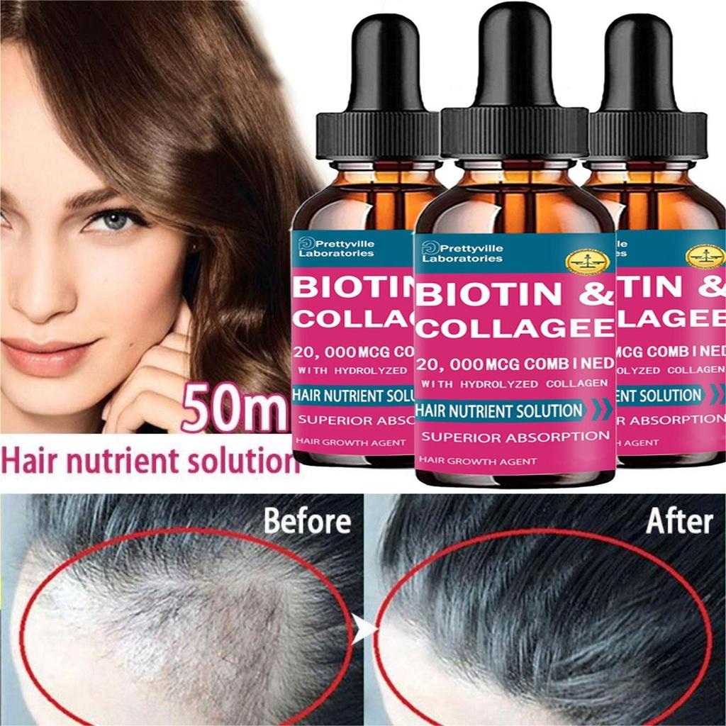 Indian Mysterious Formula Hair Growth Oil for Women Men Hair Grow Spray Fast Anti Hair-loss Head Skin Care