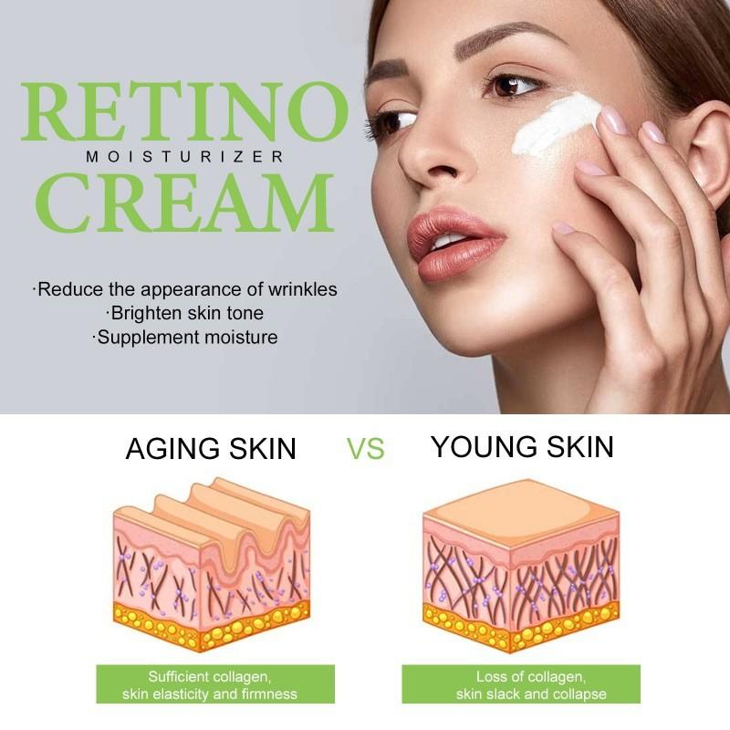 Hoygi Retinol Straffende Creme Zur Faltenreduktion Und Fleckenaufhellung In 50ml Größe