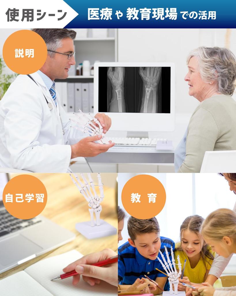 KIYOMARU Wrist Joint Model, Human Body Model, Bone Model, PT Supervised, Skeleton Specimen, Removable from Support, Right Hand, Life-Size