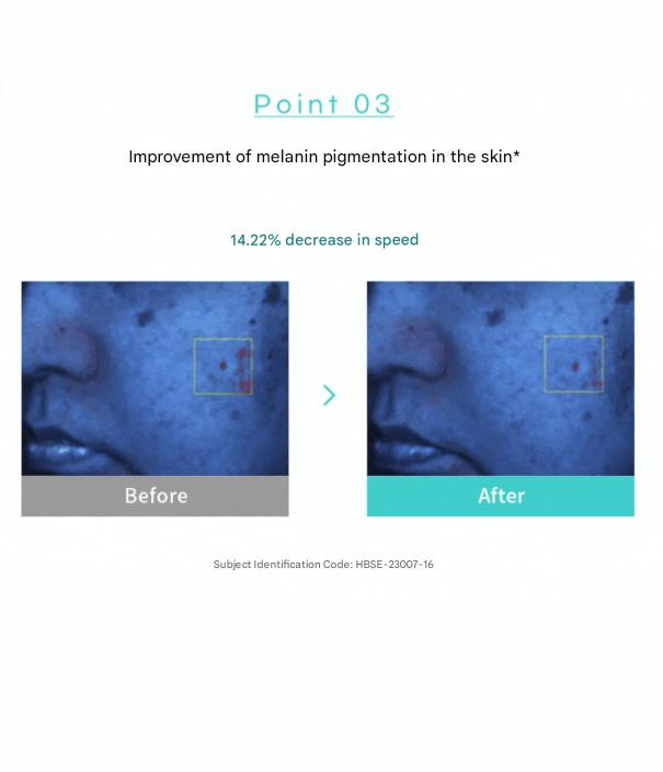 Rejuran Biome Healer Youth Formula Ampoule 30ml ,  Biome Healer Youth Formula Cream 50ml (7 Options)