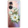 Clear Soft TPU Cover For Honor 50 Pro Lite Case Honor70 5G New Silicone Transparent Funda for Huawei Honor 70 5G Honor50 Coque