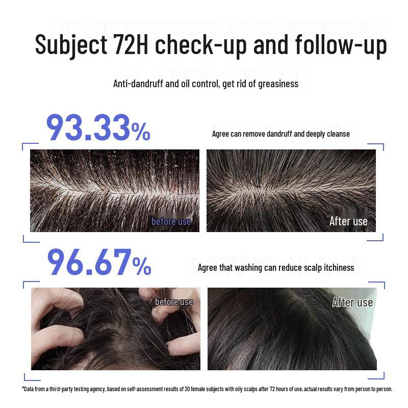 Cailè šampon proti lupům se sulfidem seleničitým