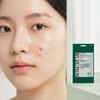 Some By Mi Clear Spot Patch 2-Type Set (9 Patches)
