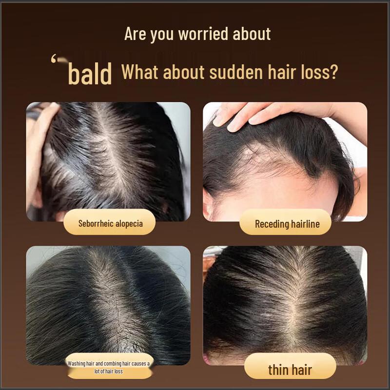 Fanou Anti-Hair Loss & Oil Control Hair Care Set