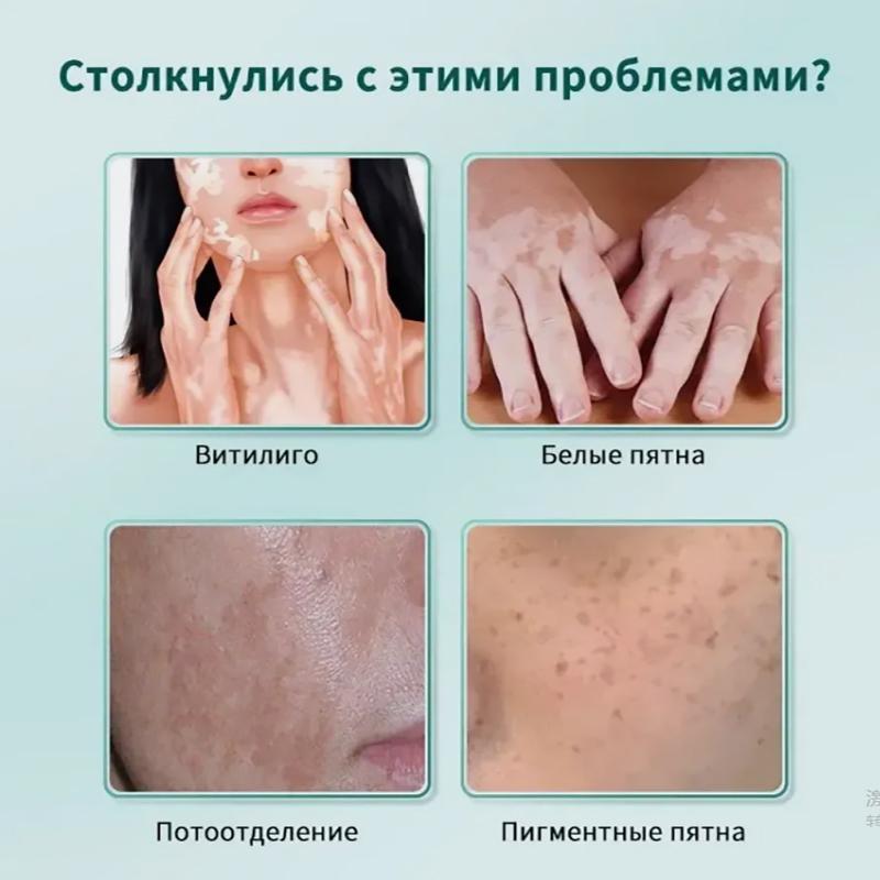 Vitiligo Relief Cream, Skin Care Cream, Vitiligo Cream, Improves Dryness, Suitable For All Skin Types