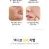 OOTD - Dark Spot Vitamin C Toner Pad